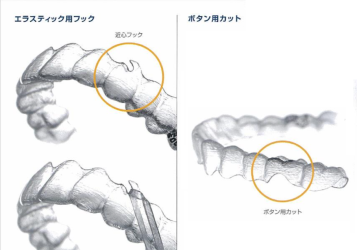 エラスティックフック、ボタンカット