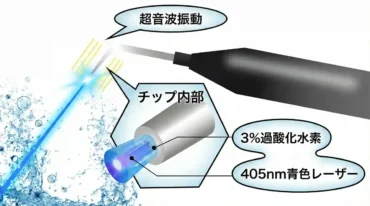 ブルーラジカル