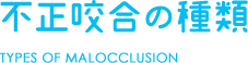 不正咬合の種類 TYPES OF MALOCCLUSION